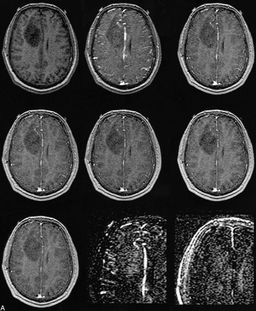 fig 2.