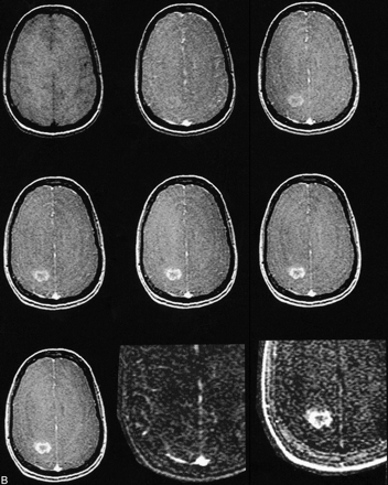 fig 2.