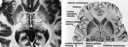 fig 1.