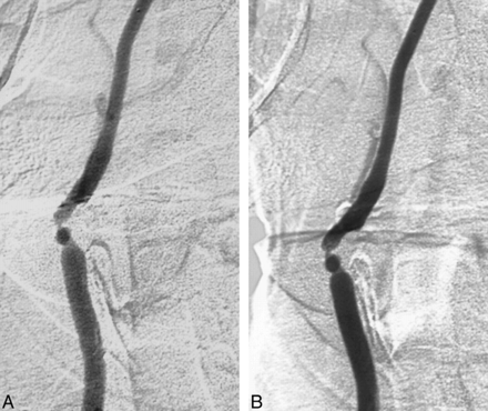 fig 3.