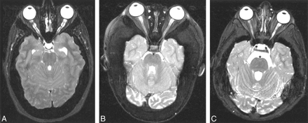 fig 2.