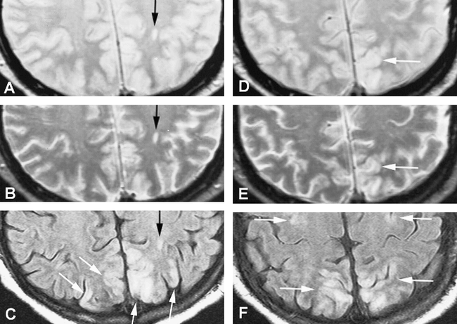 fig 4.