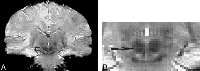 fig 5.