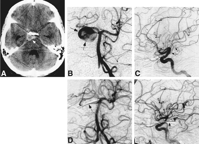 fig 1.