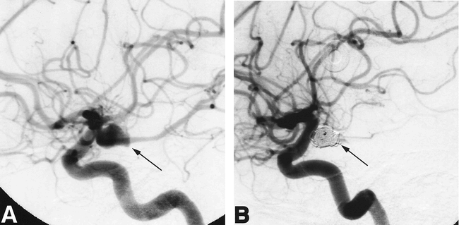 fig 3.