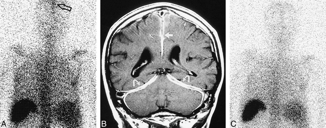 fig 1.