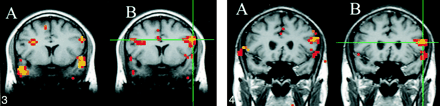 fig 2.