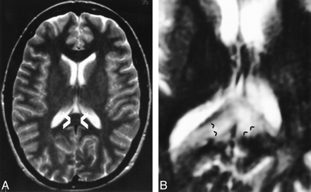 fig 3.