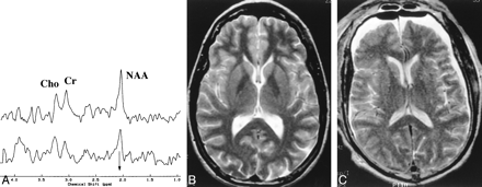 fig 4.