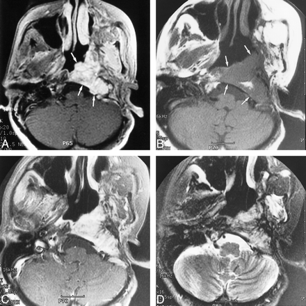 fig 2.