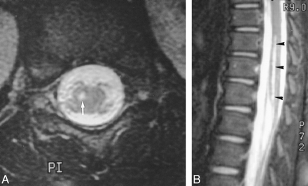 fig 3.