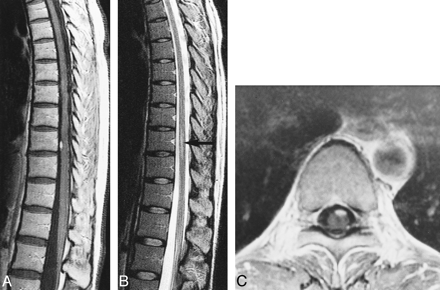 fig 5.