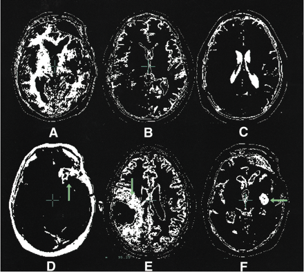 fig 3.