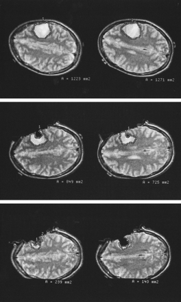 fig 3.