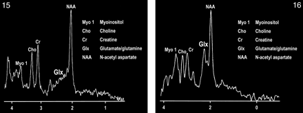 fig 15.