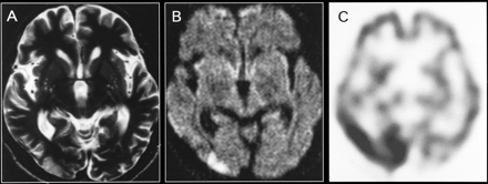 fig 3.