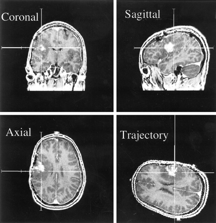 fig 1.