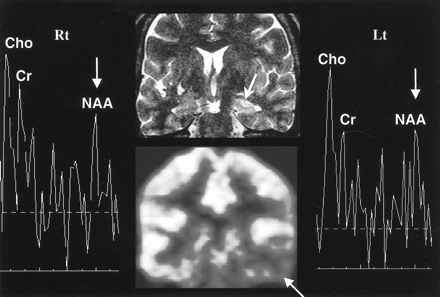 fig 3.