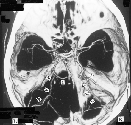 fig 4.