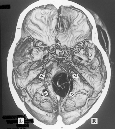 fig 8.