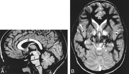 fig 1.