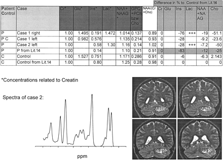 fig 3.