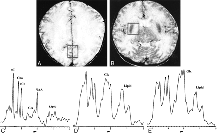 fig 1.