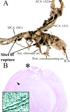 fig 6.