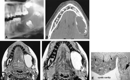 fig 2.