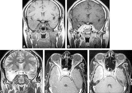 fig 3.