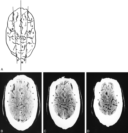 fig 6.