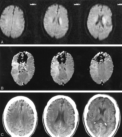 fig 2.