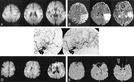 fig 3.