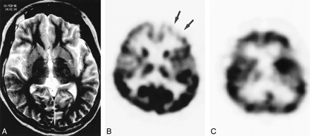 fig 3.