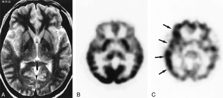 fig 4.