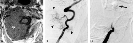 fig 2.