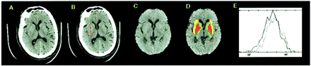 fig 2.