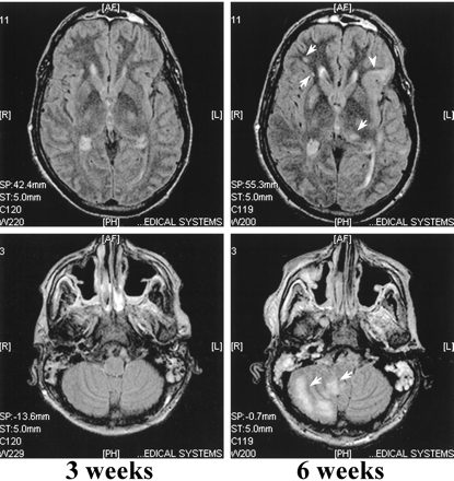 fig 3.