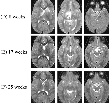 fig 1.