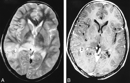 fig 2.