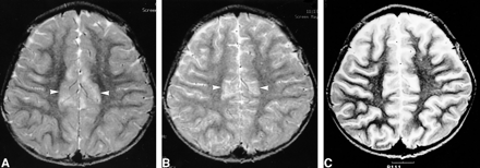 fig 6.