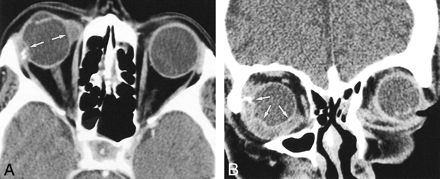 fig 2.