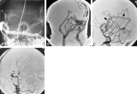 fig 2.