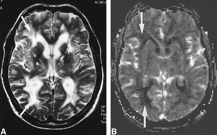 fig 2.