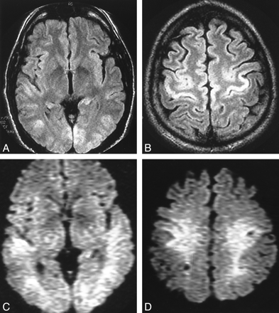 fig 1.