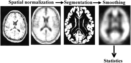 fig 1.