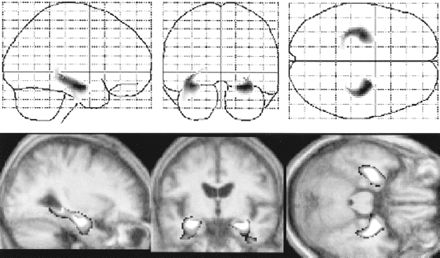 fig 3.