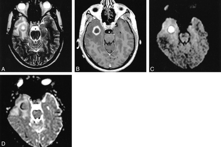 fig 2.