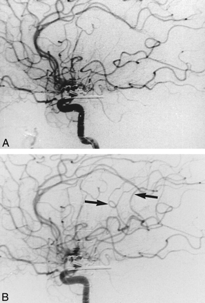 fig 2.