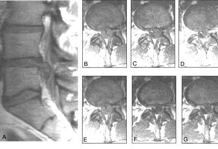 Fig 2.